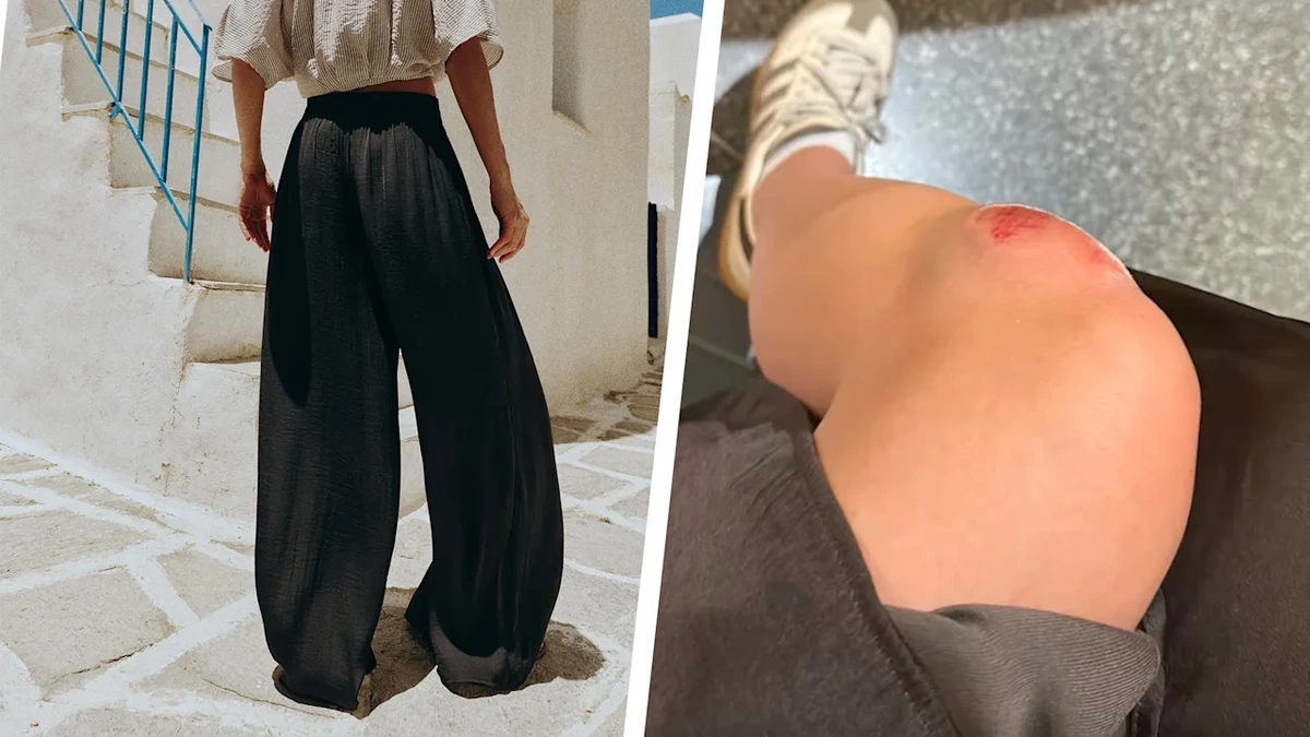 Stürze! Klinik! Immer mehr Opfer: Frauen warnen vor dieser Hose von Zara