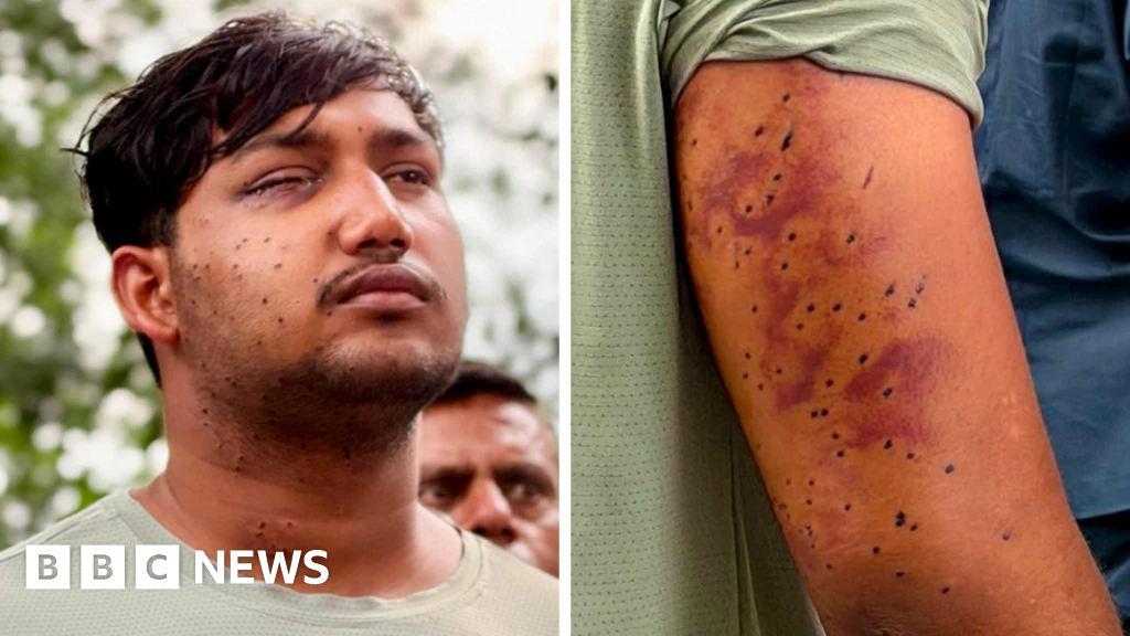 India's 'cockroach' protesters have wounds consistent with pellet-gun fire, say experts