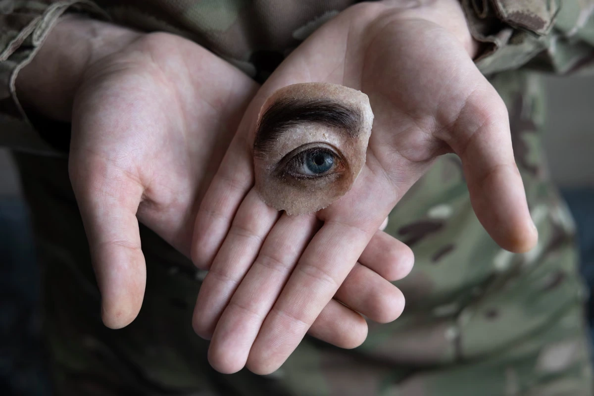 Blinded by War: documenting the aftermath of injury in Ukraine – photo essay