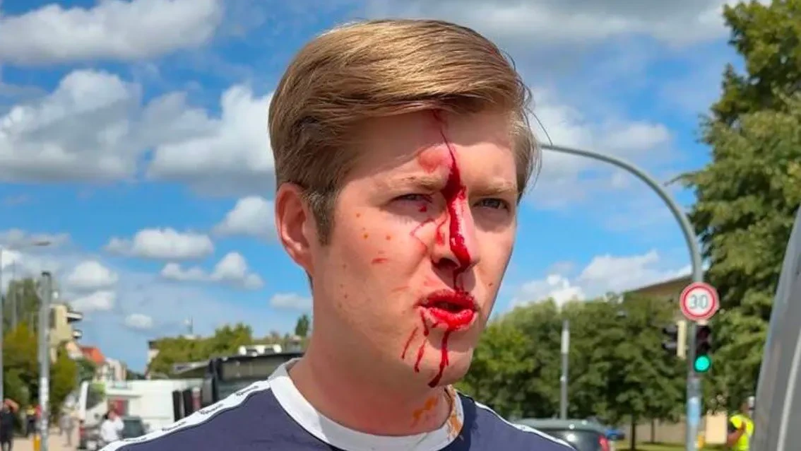 AfD-Mann bei Demo in Schwerin angegriffen und verletzt
